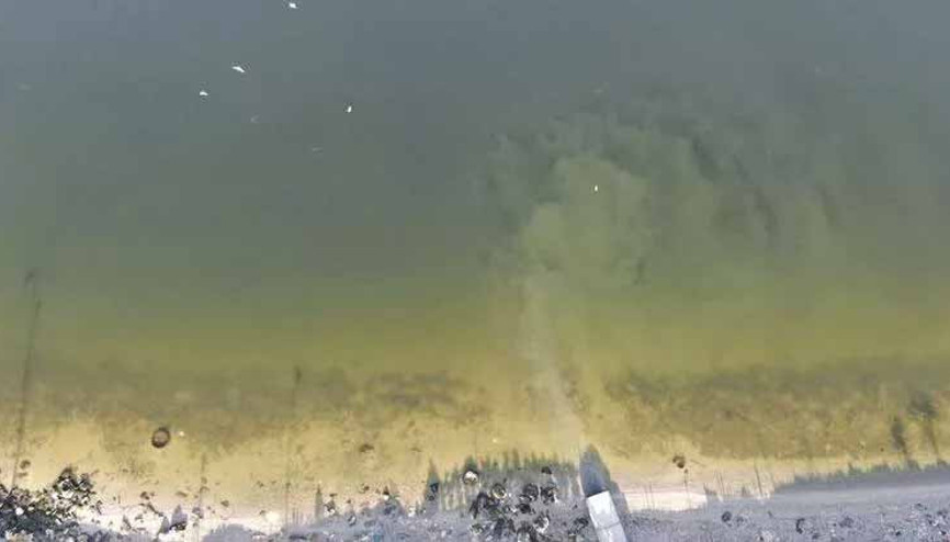 Küçükçekmecenin MRı çekildi