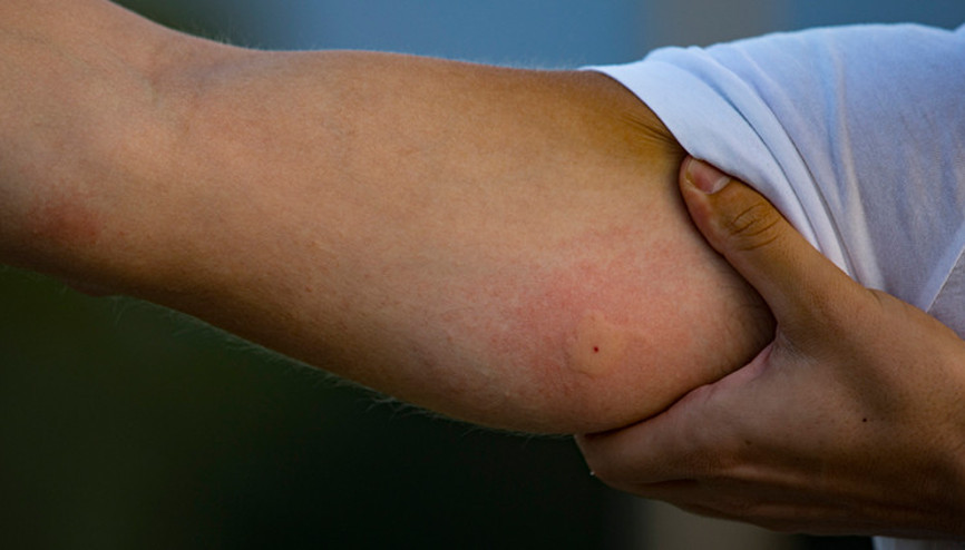 Böcek ısırığı nedeni ile doktora gitti hayatının şokunu yaşadı: Dünyamız yıkıldı, kimsenin başına gelsin istemem