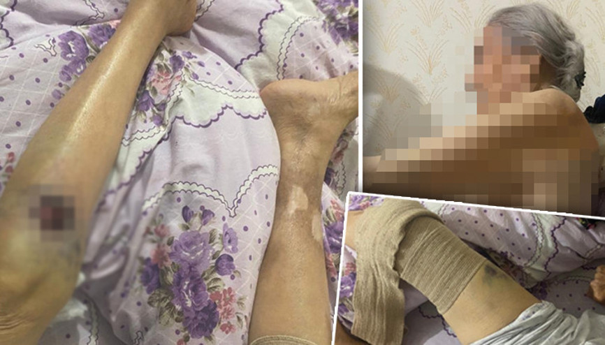 Ankarada bakıcı dehşeti 91 yaşındaki kadın kâbusu yaşadı Ankarada bakıcı dehşeti 91 yaşındaki kadın kâbusu yaşadı