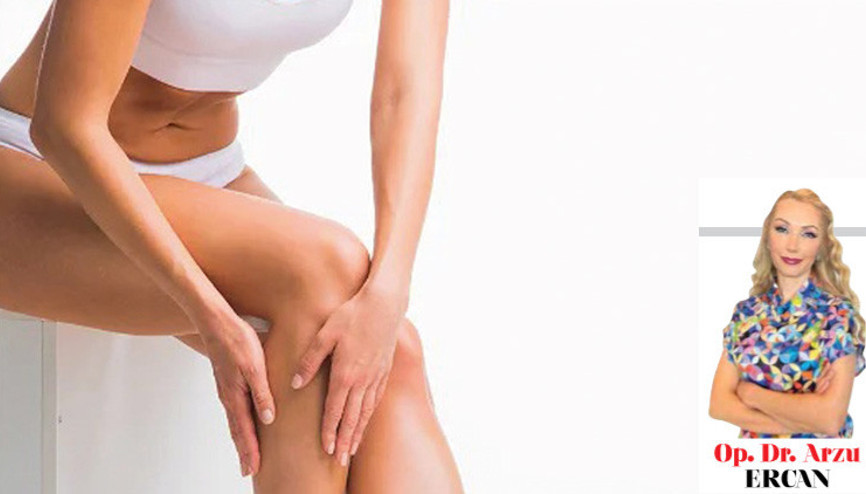 Op. Dr. Arzu ERCAN yazdı: Bacaklarımızda yıllar içinde büyüttüğümüz  “varisler” ne kadar ileriye gidebilir