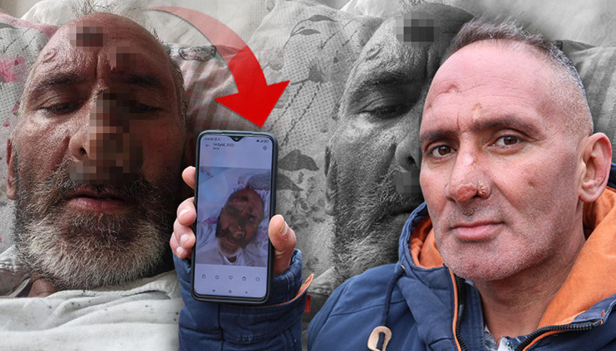 Sinek ısırığı hayatını altüst etti: Tanınmayacak hale geldi Vücudum güç üretemiyor