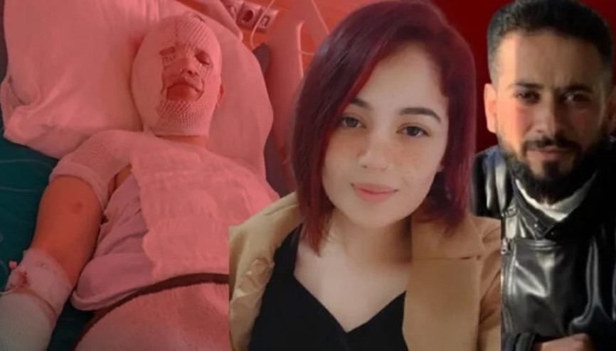 Depremzede eski eşini kaynar suyla yaktı... Artçı sarsıntı nedeniyle oldu dedi