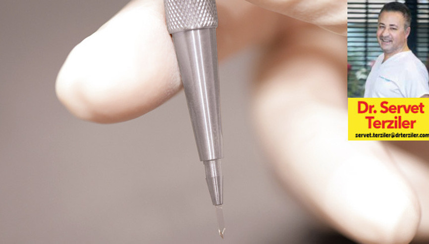 Dr. Servet Terziler yazdı: İnce safir uçlu kalemle  saç ekimi