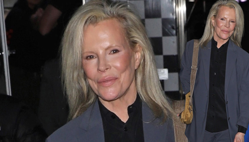 Baktılar, baktılar... Tanıyamadılar... Bir dönemin efsane güzeliydi