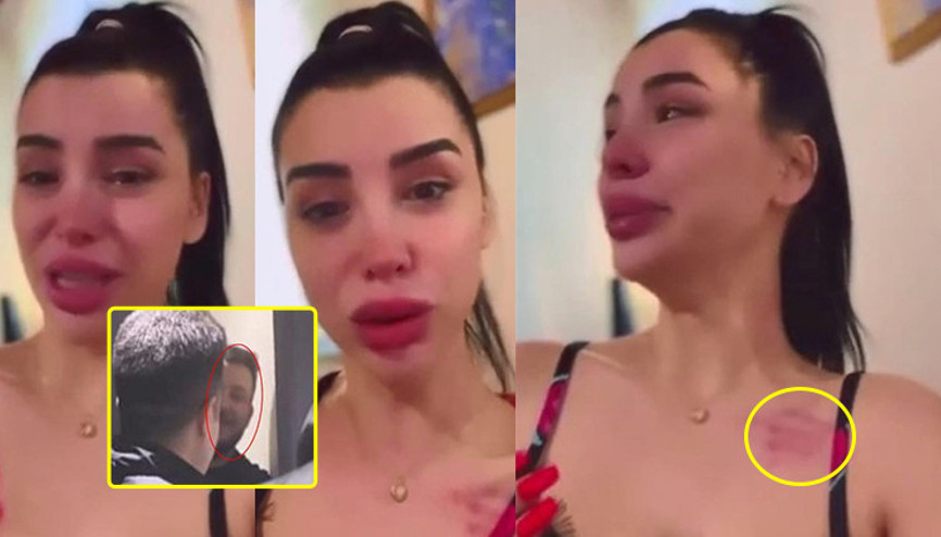Aleyna Eroğlu, Batuhan Karadeniz’den şiddet gördüğünü iddia etti