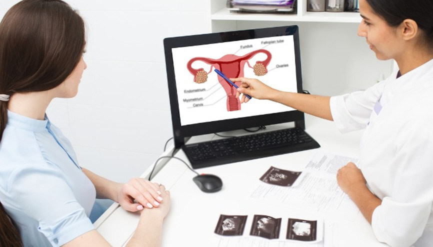 Her 4 kadından 1’inde görülüyor Rahim miyomları hakkında bilinmesi gereken 5 önemli nokta Her 4 kadından 1’inde görülüyor Rahim miyomları hakkında bilinmesi gereken 5 önemli nokta