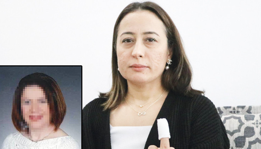 Kıskançlık ısırığına 2 yıl hapis istendi