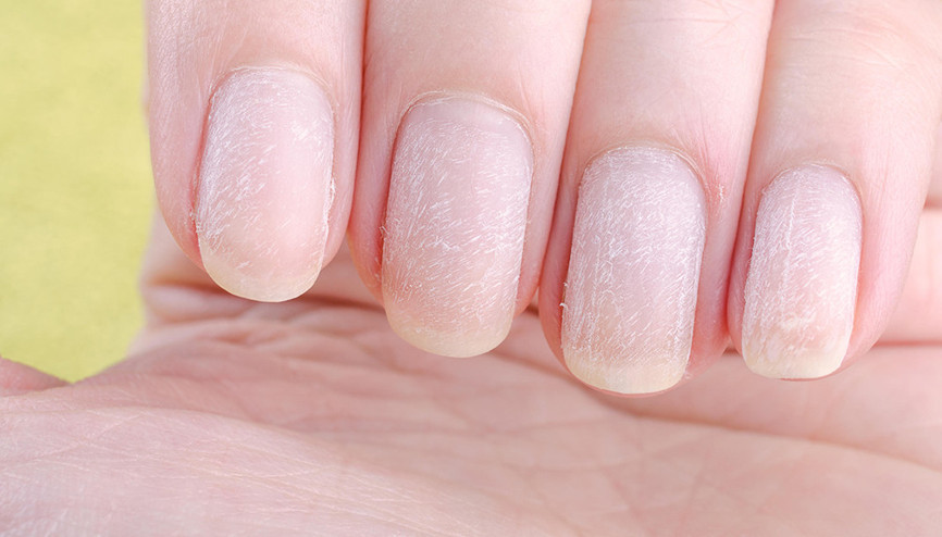 JEL TIRNAKLARDAKİ GİZLİ TEHLİKE: Uzun süre bozulmuyor ama sinsice sağlığımızla oynuyor