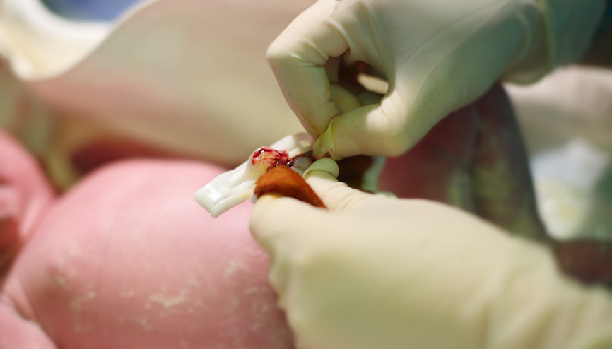 Lösemiye yakalandı, bir bebeğin kordon kanı ile iyileşti… ‘80’den fazla hastalığın tedavisinde kullanıyor’