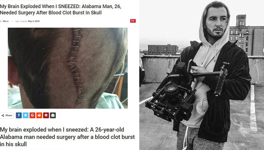 Hapşırınca sonra beynim patladı, burnumdan kan gelmeye başladı 3 ameliyat geçirdi, günlerce hastanede kaldı...