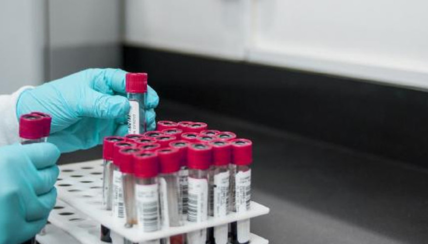 İngiltere’de bulaşıcı cinsel hastalıklar rekor seviyeye yükseldi