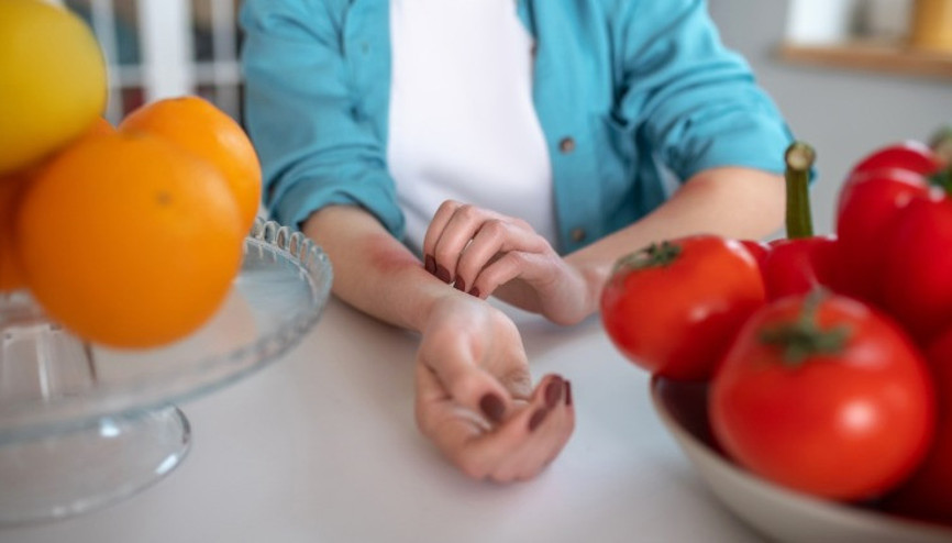 Alerjiler hep bu kadar yaygın mıydı, yoksa giderek daha mı fazla alerji oluyoruz Herkes yaşamı boyunca en az bir kez bu sorunu yaşar
