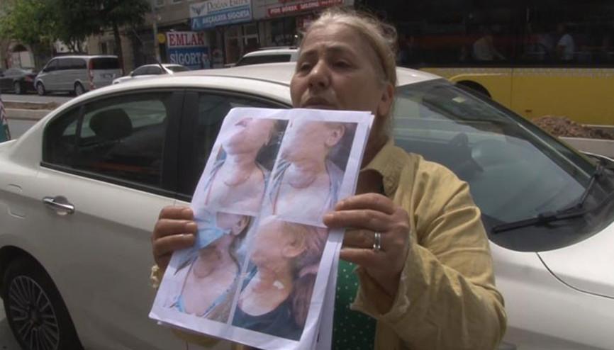 Diş tedavisine giden kadın kâbusu yaşadı... Narkoz sonrası yoğun bakıma alındı