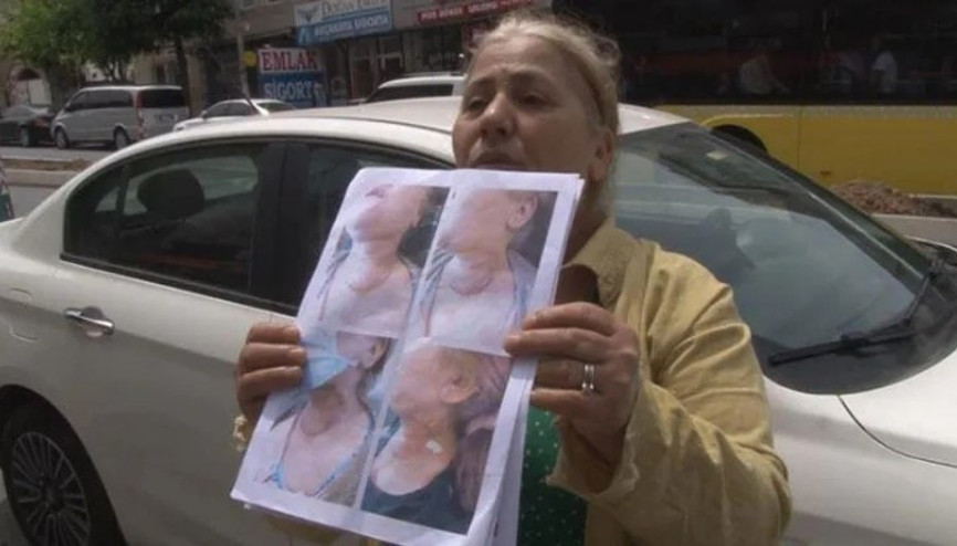 Sancaktepe’de özel bir klinikte diş tedavisine giden kadın kâbusu yaşadı... Narkoz sonrası yoğun bakıma alındı