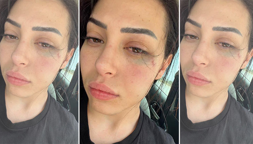 GKRY’da saldırıya uğrayan Karaali’nin duruşması 6 Temmuz’da yapılacak