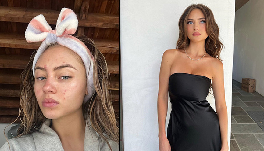 Genç model için “annesinden torpilli” diyorlar: Yüzünün gerçek halini makyajsız selfie’siyle paylaştı