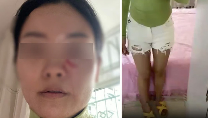 Gelininin şortunu kısa bulan kayınpeder öfkeden deliye döndü Sıcak çorbayı başından aşağı döküp tehditler savurdu