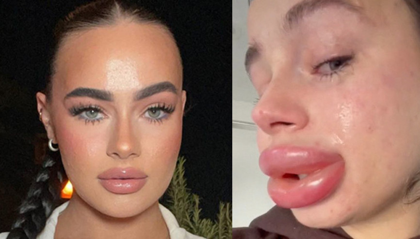 Bedava dolgu kabusundan zor uyandı Bedava dolgu kabusundan zor uyandı