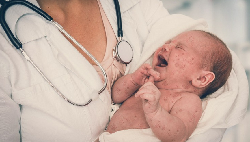 Çocuklardan sonra şimdi de yetişkinler kızamık riski altında... 10 soru 10 yanıt