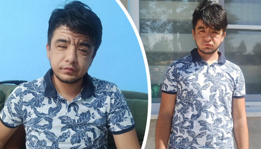 Dünyada nadir görülen hastalığa yakalandı 20 yaşındaki Enes: Herkes 40 yaşında gösterdiğimi söylüyor Dünyada nadir görülen hastalığa yakalandı 20 yaşındaki Enes: Herkes 40 yaşında gösterdiğimi söylüyor