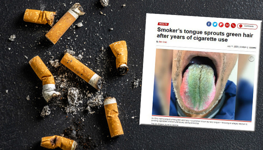 Dili bir anda tüylenmeye başladı ve yeşile döndü Sebebi tıp dergisine konu oldu