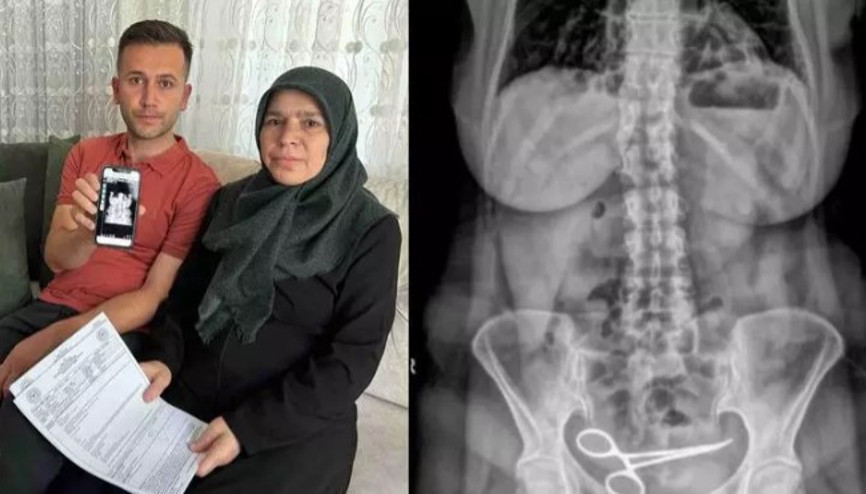 Gerçek röntgende ortaya çıktı 8 ay karnında yaşadı