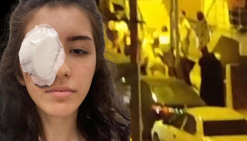 Evinin önünde oturan 16 yaşındaki çocuğa maganda kurşunu... Sol gözünü kaybetti