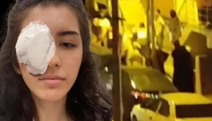 Küçükçekmecede maganda kurşunu nedeniyle 16 yaşındaki çocuk bir gözünü kaybetti