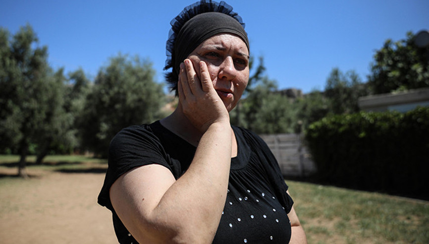 Delirten hastalık 2 çocuk annesi kadının hayatını altüst etti: Yüzümün sağ tarafından nefret ediyorum