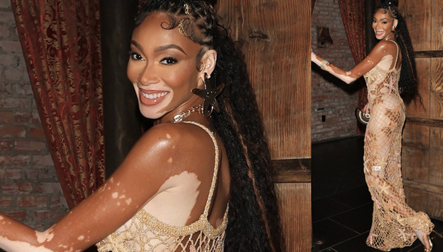 Herkesin alay ettiği günler geride kaldı: Hastalığı şansı oldu, hayatını değiştirdi