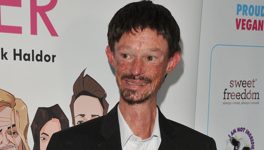 Taht Oyunları (Game of Thrones) dizisinde rol alan Darren Kent hayata veda etti: Onu tanımak bir ayrıcalıktı