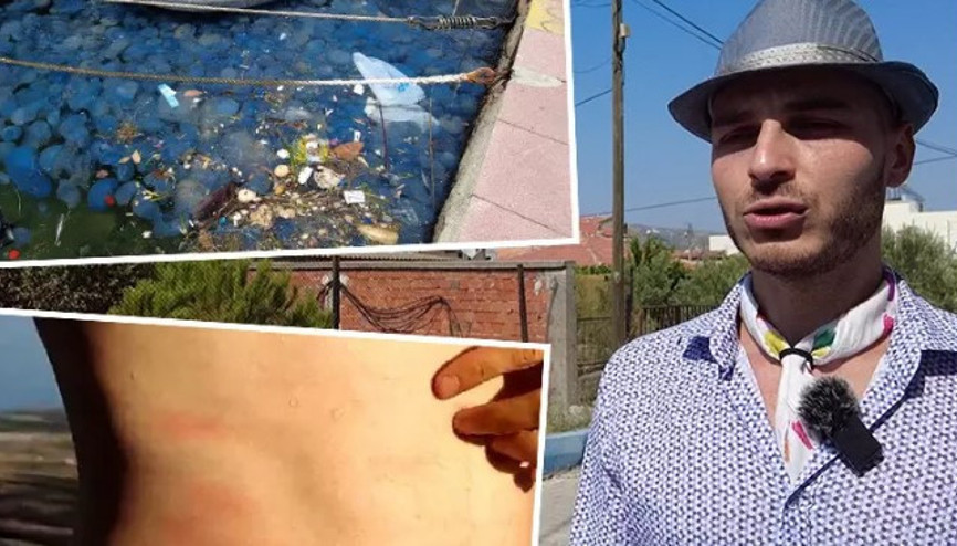 İzmirin Foça ilçesinde, denizanası istilasının ardından vakalar arttı