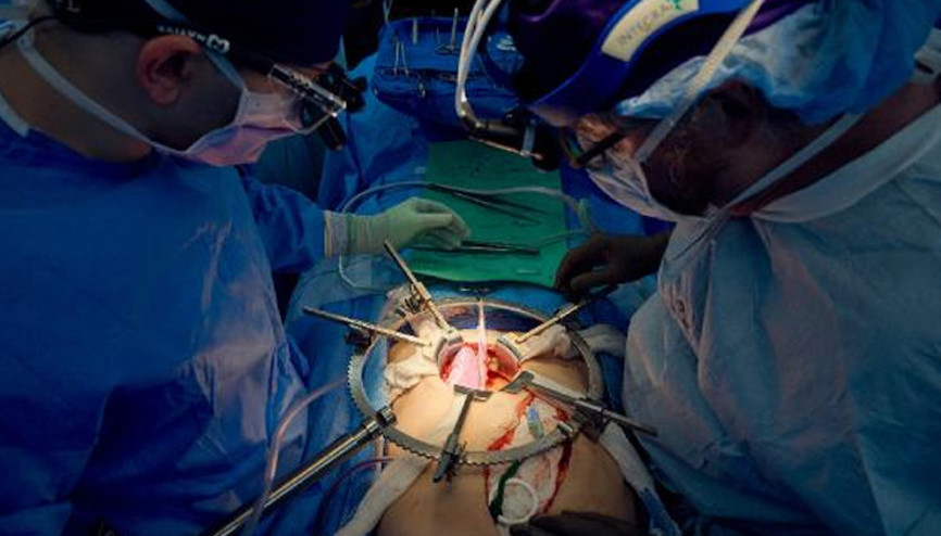 Domuz böbreği, 32 gün boyunca insan vücudunda çalıştı