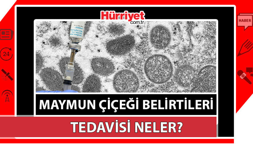 Maymun çiçeği virüsü nedir, belirtileri nelerdir Maymun çiçeği nasıl bulaşır Uzmanlardan uyarı