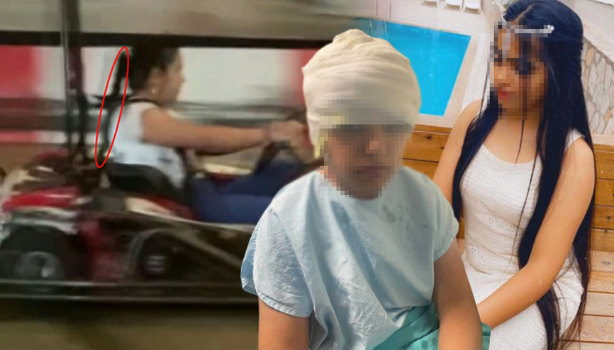 Go-kart pistinde facia Kız çocuğu ölümden döndü; saç derisi saatler süren ameliyatla dikildi