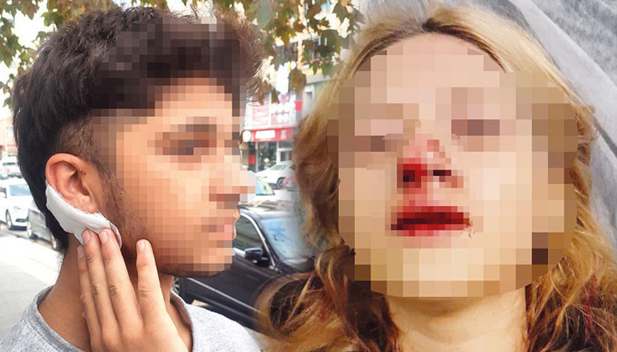 Bunları yapan çocuk Yüzüne kaldırım taşı attılar, kulağını yardılar