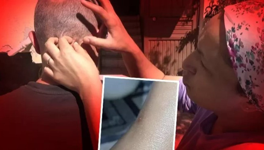 Hatayda böcekler önce evlerini sonra vücutlarını istila etti