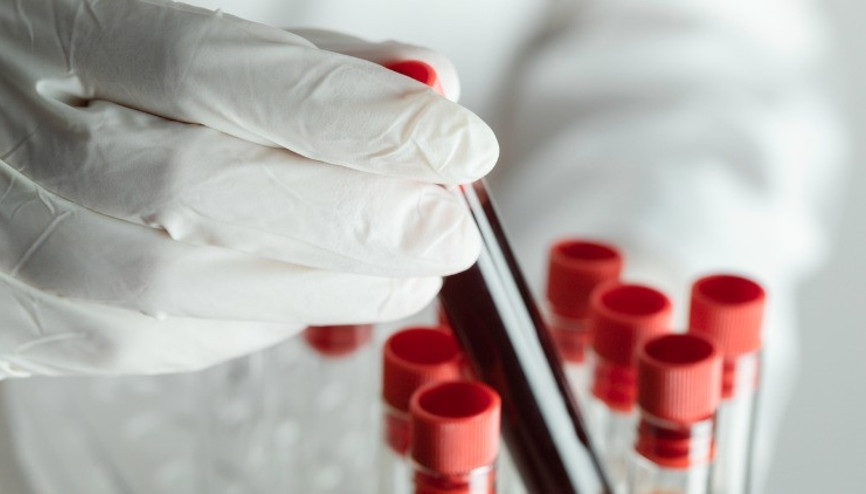 Gebeliğimin altı haftası hatırlamak istemediğim anlara dönüştü... Ücretsiz SMA testleri hakkında merak edilen 12 soru 12 yanıt
