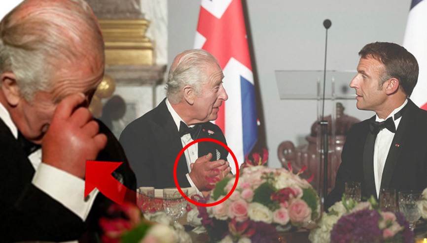 Fransa ziyaretine Kralın sosis parmakları damga vurdu İngiliz medyası doktorlara nedenini doktorlara sordu...