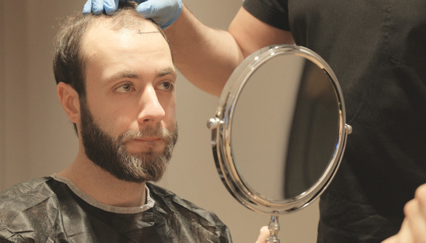 Dr. Servet Terziler yazdı: Kaygı düzeyiniz yüksekse  ‘Sedasyonlu saç ekimi’ size göre...