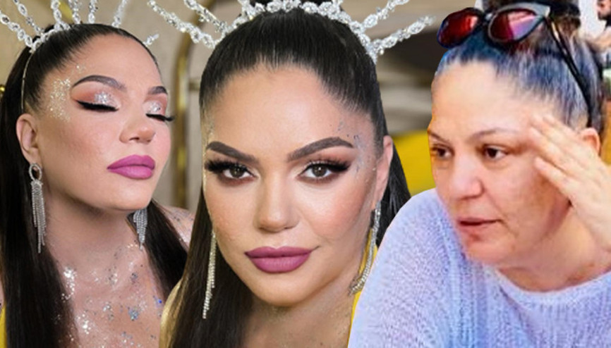 Eleştiriler İzeli çileden çıkardı: Yüzümdeki çukurların silinmesini istedim