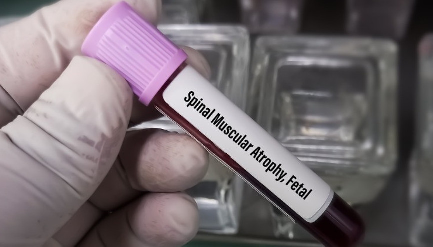 Ücretsiz SMA testleri hakkında merak edilen 12 soru 12 yanıt