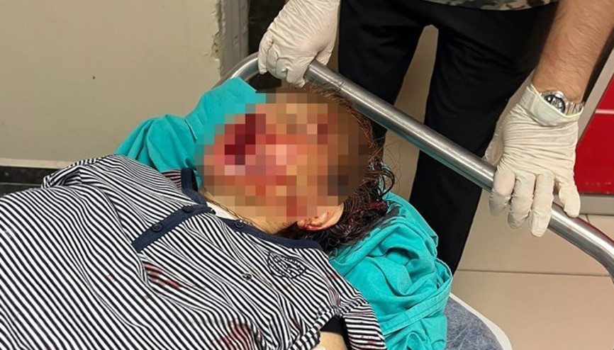 Vicdansızlar Torunları tarafından demir kürekle darbedildi