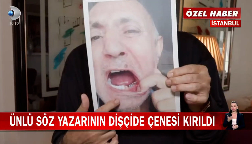 Ünlü söz yazarı Mehmet Yüzüakın dişçide çenesi kırıldı
