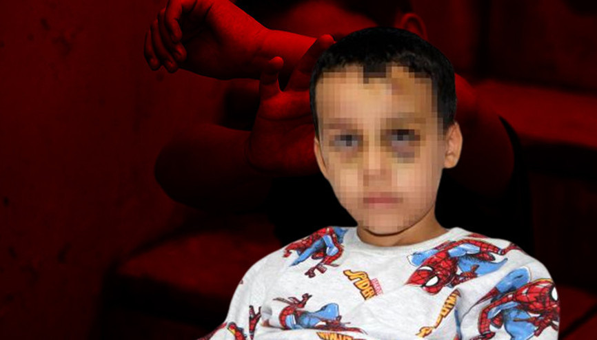 Yuvada bakıcı dehşeti Dövüp yere fırlattığı çocuğun kafatası kırıldı, gözleri morardı Yuvada bakıcı dehşeti Dövüp yere fırlattığı çocuğun kafatası kırıldı, gözleri morardı