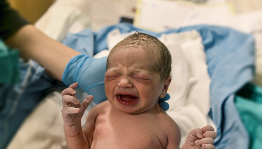 Normal doğanlar daha mı zeki Sezaryen bir doğum şekli değil mi 13 SORU 13 CEVAP