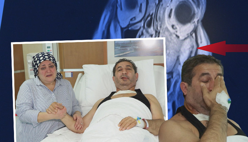 Yüzündeki sertliği fark edince korkunç gerçek ortaya çıktı: 1 ay daha gecikse gözünü kaybedecekti