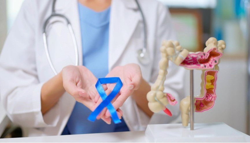 Kolon Kanseri belirtileri nelerdir Sinsice ilerliyor... Erken teşhis hayati önem taşıyor Kolon kanseri nedir, neden olur, tedavisi var mı