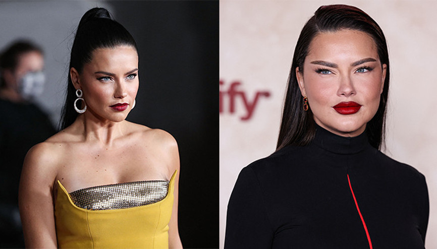 Estetik yaptırdığını söyleyenlere ateş püskürdü: Bu sadece yorgun bir annenin yüzü Estetik yaptırdığını söyleyenlere ateş püskürdü: Bu sadece yorgun bir annenin yüzü