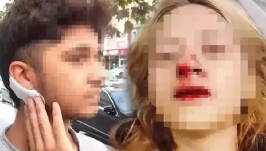 Lise öğrencisi Mervenurun yüzüne taş atıp dişlerinin kırılmasına neden olmuştu: Tahliye edildi